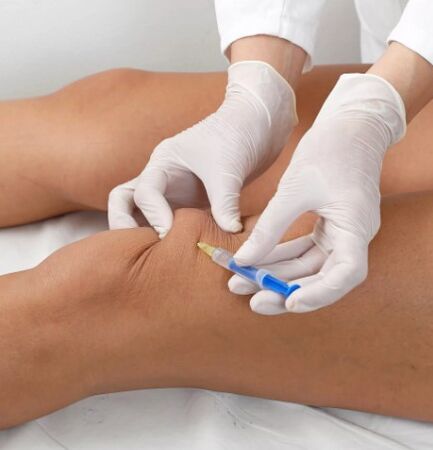 Ozonotherapy