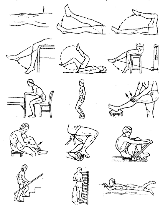 Therapeutic exercises for knee joint arthrosis