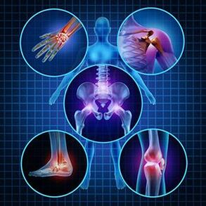 How to facilitate the movement of arthritis and arthrosis in treatment