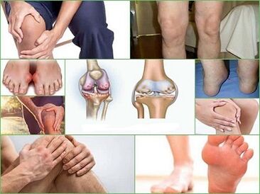 How to prevent the development of arthritis and arthritis
